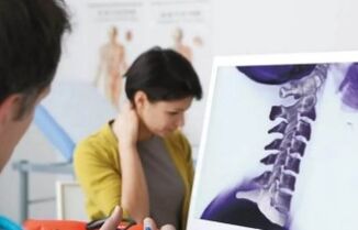 Behandlung der zervikalen Osteochondrose
